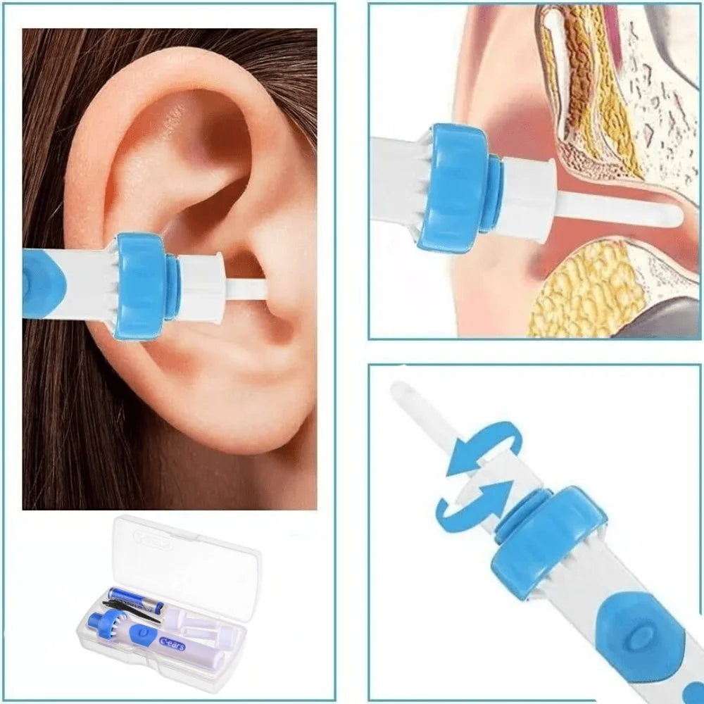 Electric Ear Wax Removal Tool